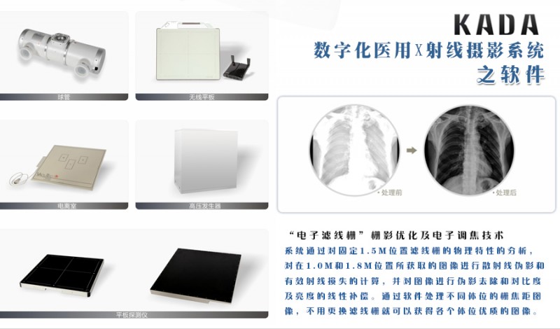 X射線攝影系統全部3_05