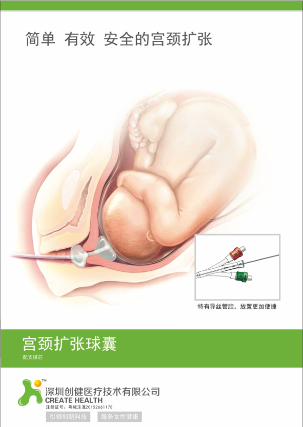 產科耗材子宮頸擴張球囊   全國招商