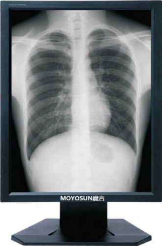 3M醫用顯示器 3M灰階顯示器 3M醫用豎屏顯示器