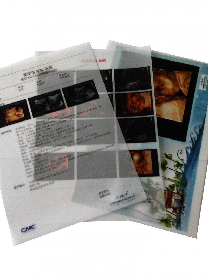 醫用打印膠片（商品名：超聲PACKS醫用診斷報告膠片）