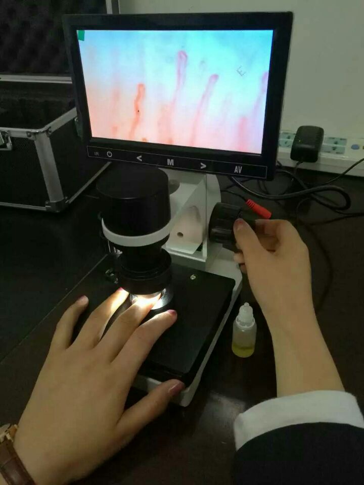 彩色微循環檢測儀