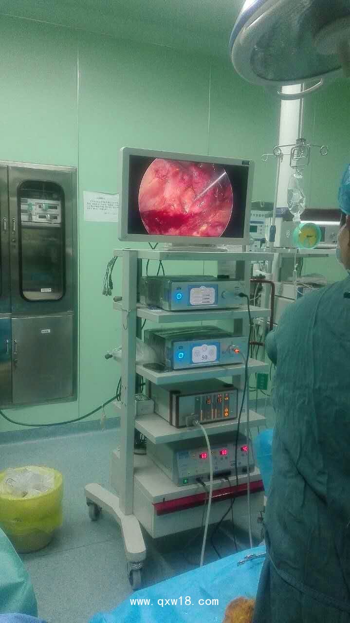 德國MGB高清腹腔鏡，高清膀胱鏡，高清輸尿管腎鏡，鼻竇鏡