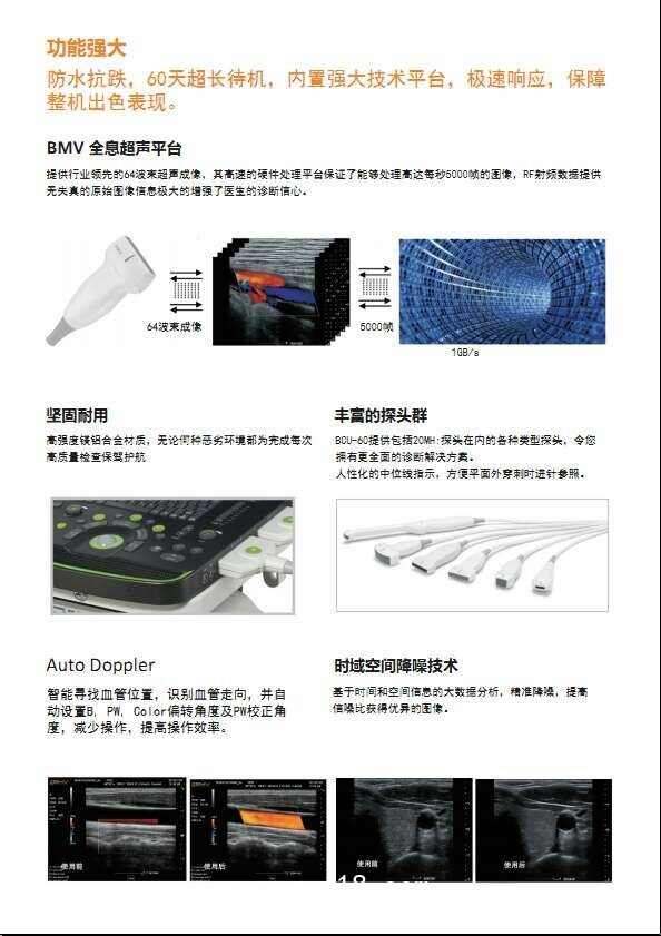 B超，監(jiān)護(hù)儀，心電圖，血壓計(jì)