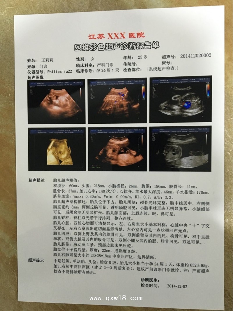 醫用超聲膠片 醫用膠片 醫用B超膠片 醫用彩超膠片