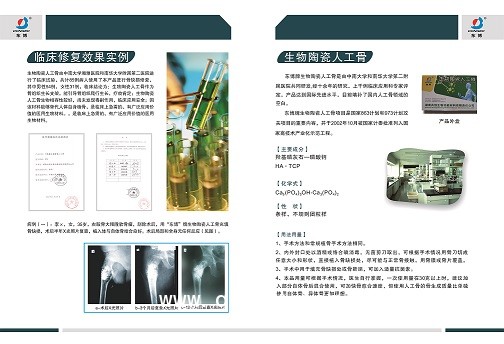 人工骨