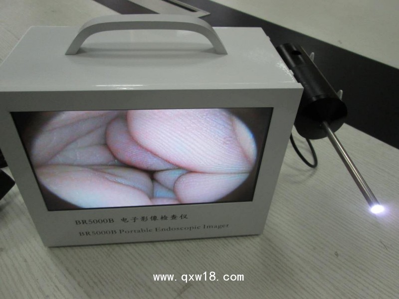 內窺鏡