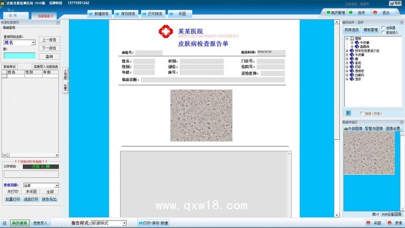 巨渺 皮膚真菌鏡檢 影像工作站 皮膚真菌圖文報告系統
