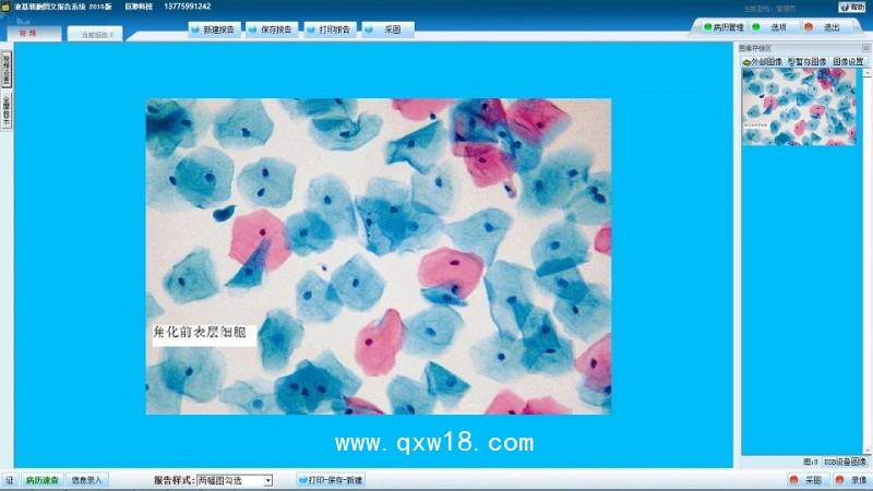 液基薄層細胞學檢測系統 TBS TCT液基圖文報告系統軟件