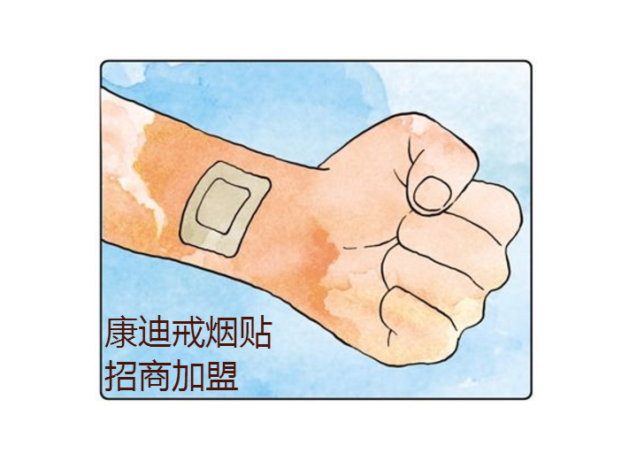戒煙貼招商加盟康迪專業戒煙貼加工廠家