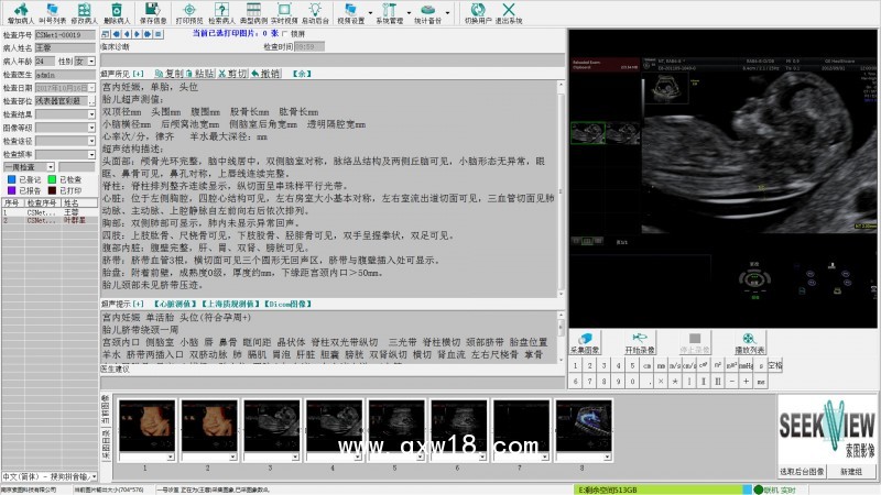 醫學影像工作站系統軟件