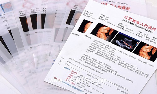 醫用打印膠片2