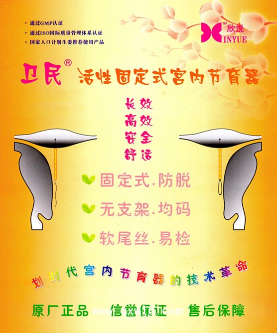 固定式宮內節(jié)育器