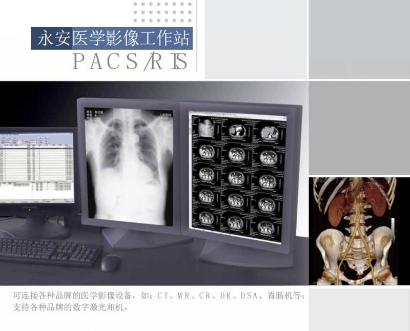 影像工作站（超聲、DR、CT、核磁）軟件廠家