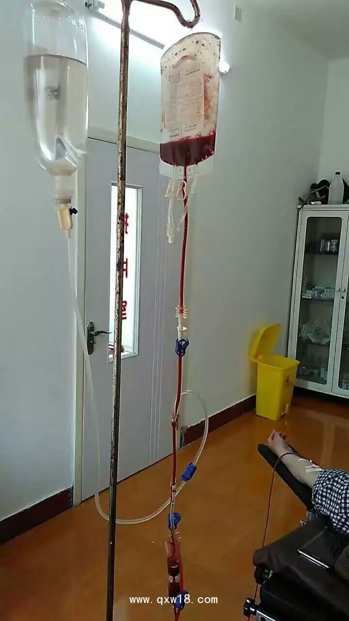 臭氧自體血血袋、萊士血袋、臭氧血袋廠家專供
