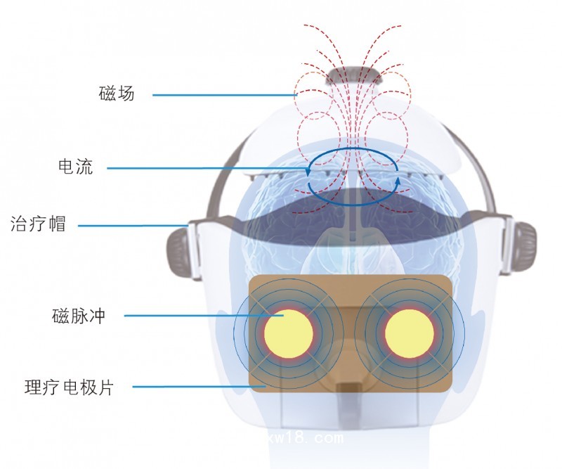 腦循環功能障礙治療儀