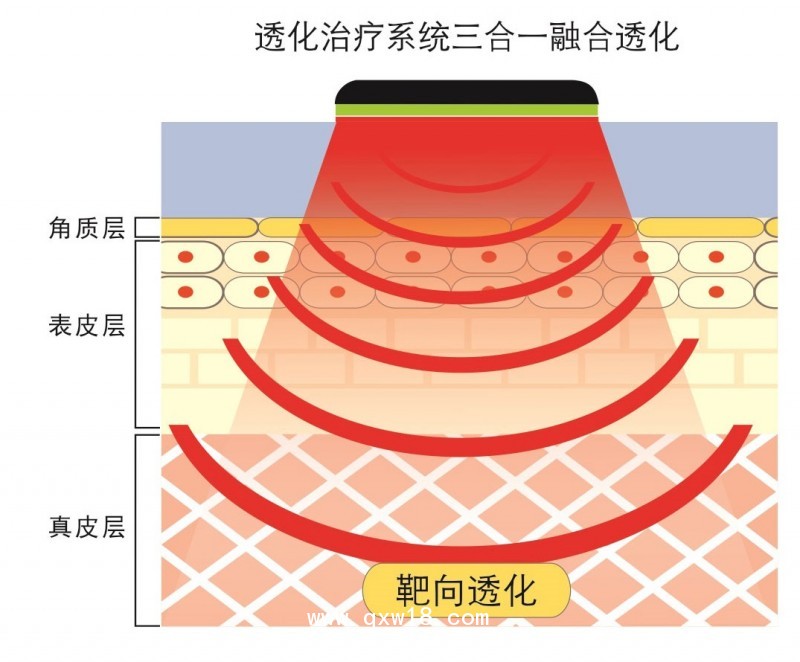 透化治療系統