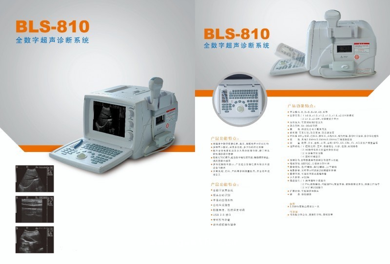 全數字超聲診斷系統