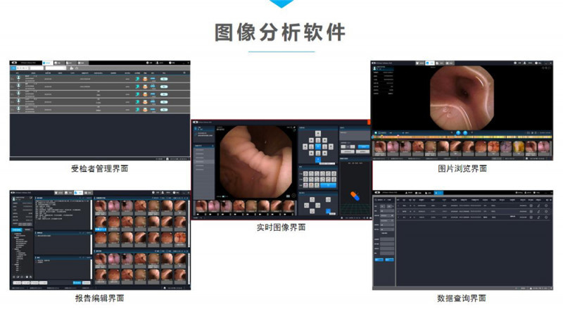 磁控膠囊式內窺鏡系統MCS-600