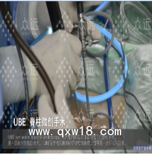 UBE全套脊柱手術(shù)器械 UBE鏡下融合 UBE培訓(xùn)