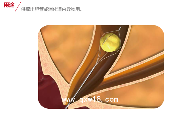 一次性使用取石網籃（A1三瓣花瓣形）