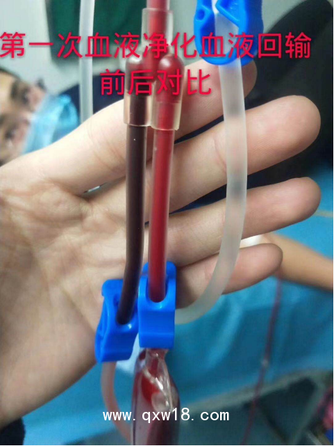 醫(yī)用臭氧治療儀便攜式三類(lèi)臭氧機(jī)
