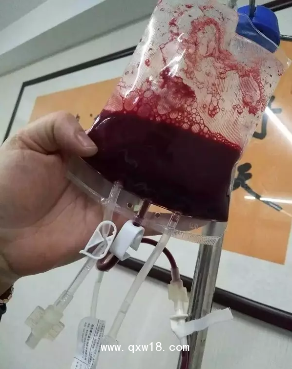 一次性大自血血袋，一次性輸血器，醫用臭氧儀等耗材產品批發