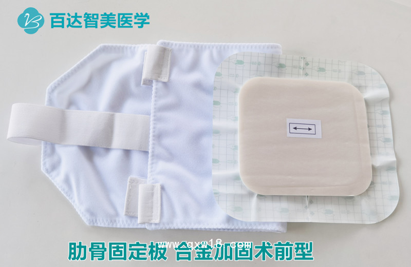 肋骨固定板合金加固術前型200