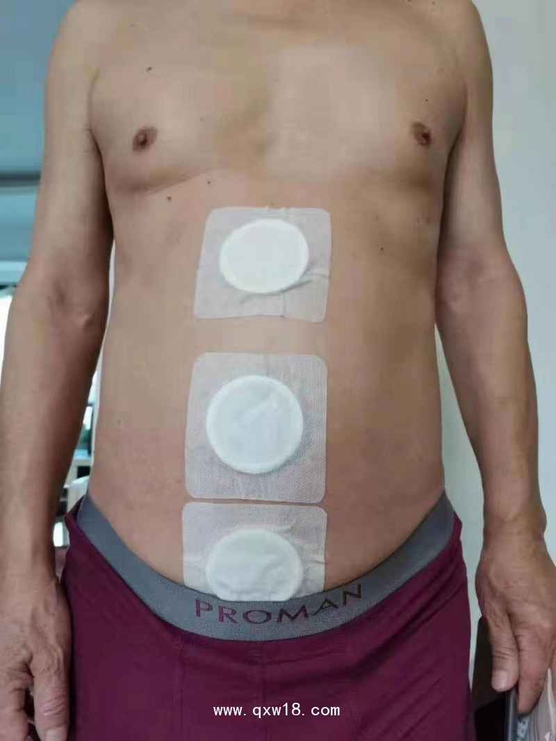 腫瘤止痛產品 癌痛貼   腫瘤科產品