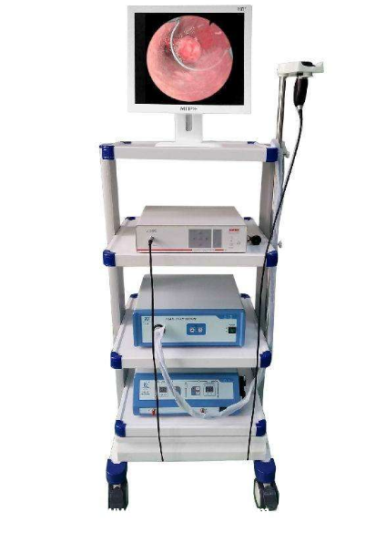 宮腔鏡醫用高清婦科檢查宮腔鏡高清內窺鏡攝像系統國產宮腔鏡