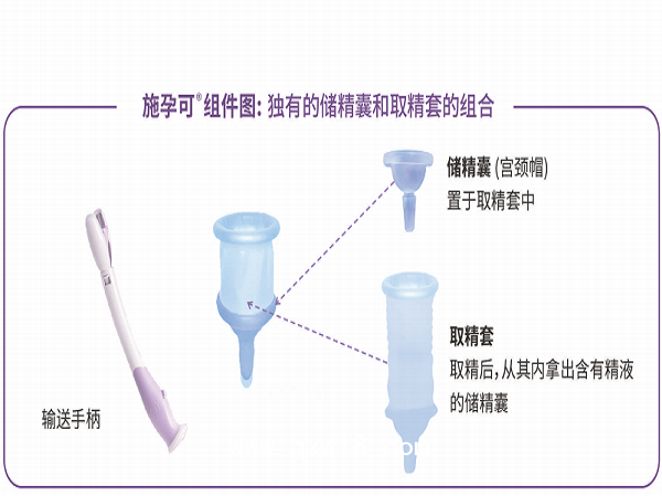 美國施孕可授精輔助系統家用助孕器