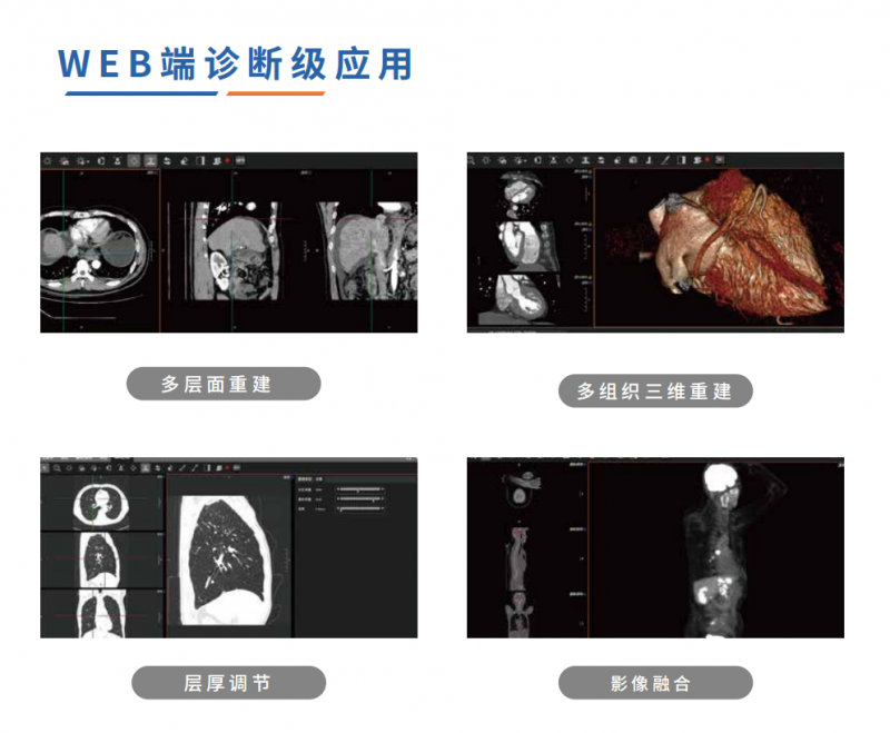 全球影像·數字影像服務(云膠片)