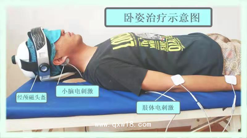 初鴻腦循環功能障礙治療儀BW-6911 腦功能治療儀 腦循環