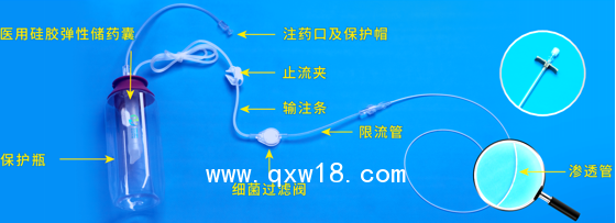 一次性使用術后局部麻醉鎮痛系統