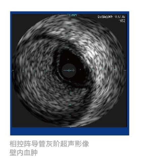 美國VOLCANO血管內超聲波診斷儀 S5