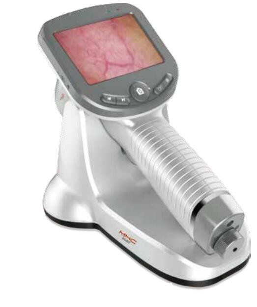 創弘醫用電子皮膚鏡影像系統 CH-DSIS-2000