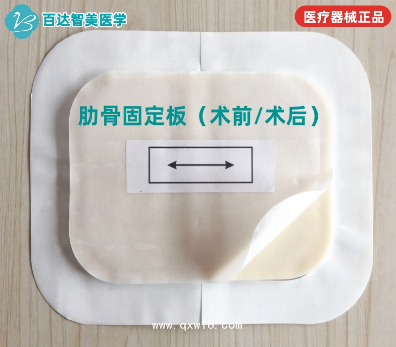 肋骨固定板/心胸外科術(shù)后護板/可塑形記憶合金夾板百達智美醫(yī)學