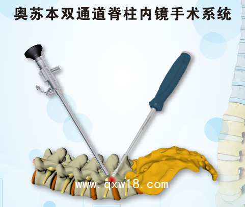 骨科脊柱微創手術器械 山東奧蘇本生產廠家