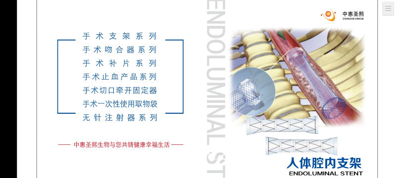 手術支架消化系統支架腸道支架膽道支架