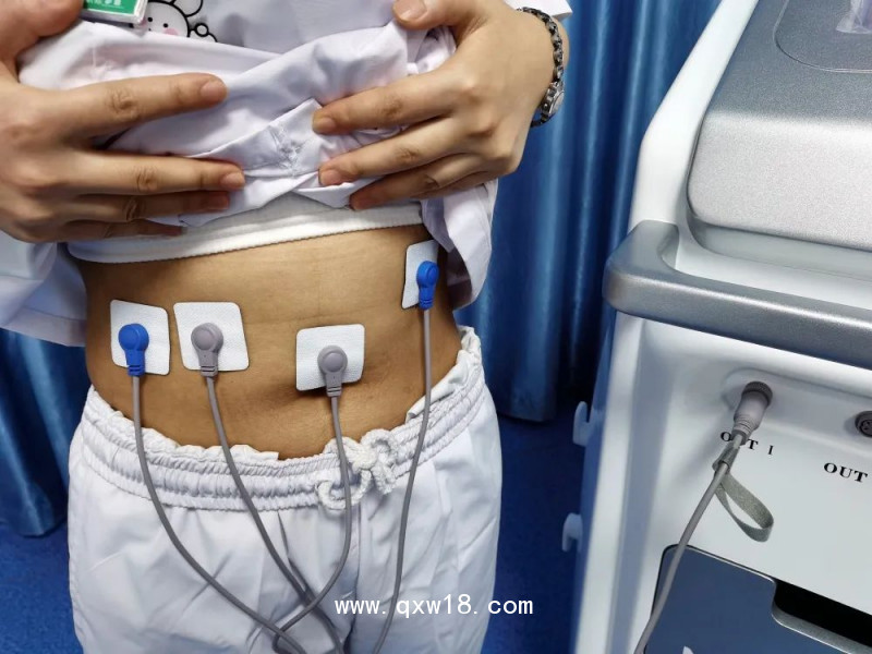 中頻胃腸治療儀 術后排氣綜合治療 胃腸動力恢復