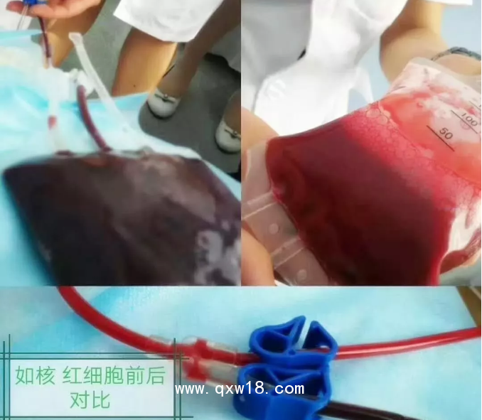 臭氧治療儀