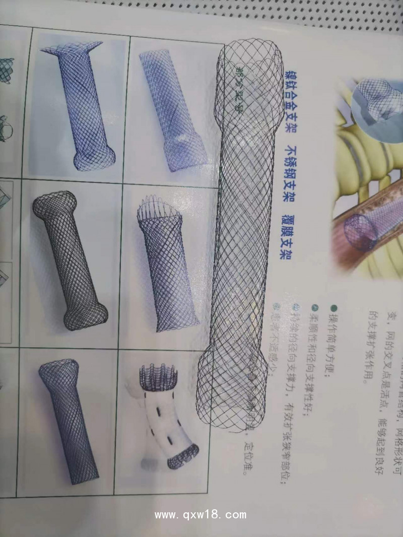 腸道支架