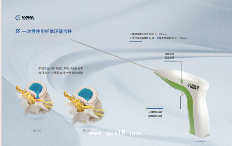 一次性使用纖維環縫合器