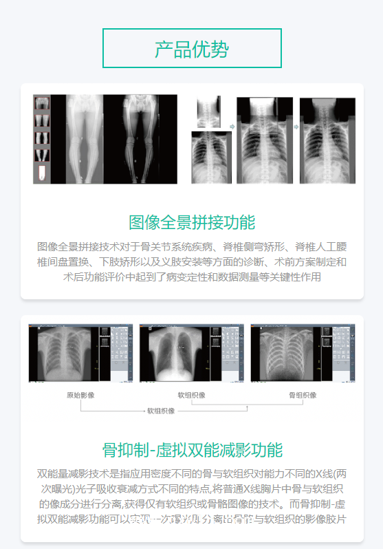 深圖SONTU 數字化X射線成像系統 SONTU100-Polaris50