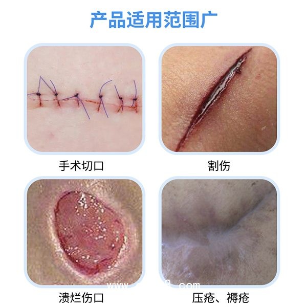醫用無菌水膠體敷料