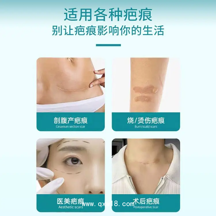 疤痕貼 巴痕痘疤燒傷疤修復 正規資質 膚色透明均可加工定制廠