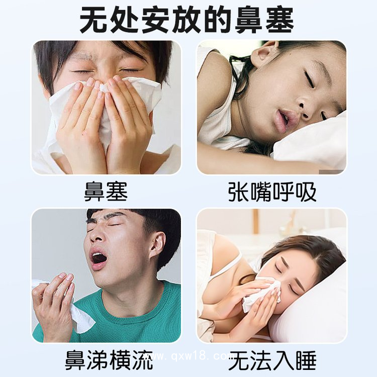 通氣鼻貼貼牌定制   穴位鼻貼OEM代加工 鼻貼生產廠家 九興藥業 現貨批發