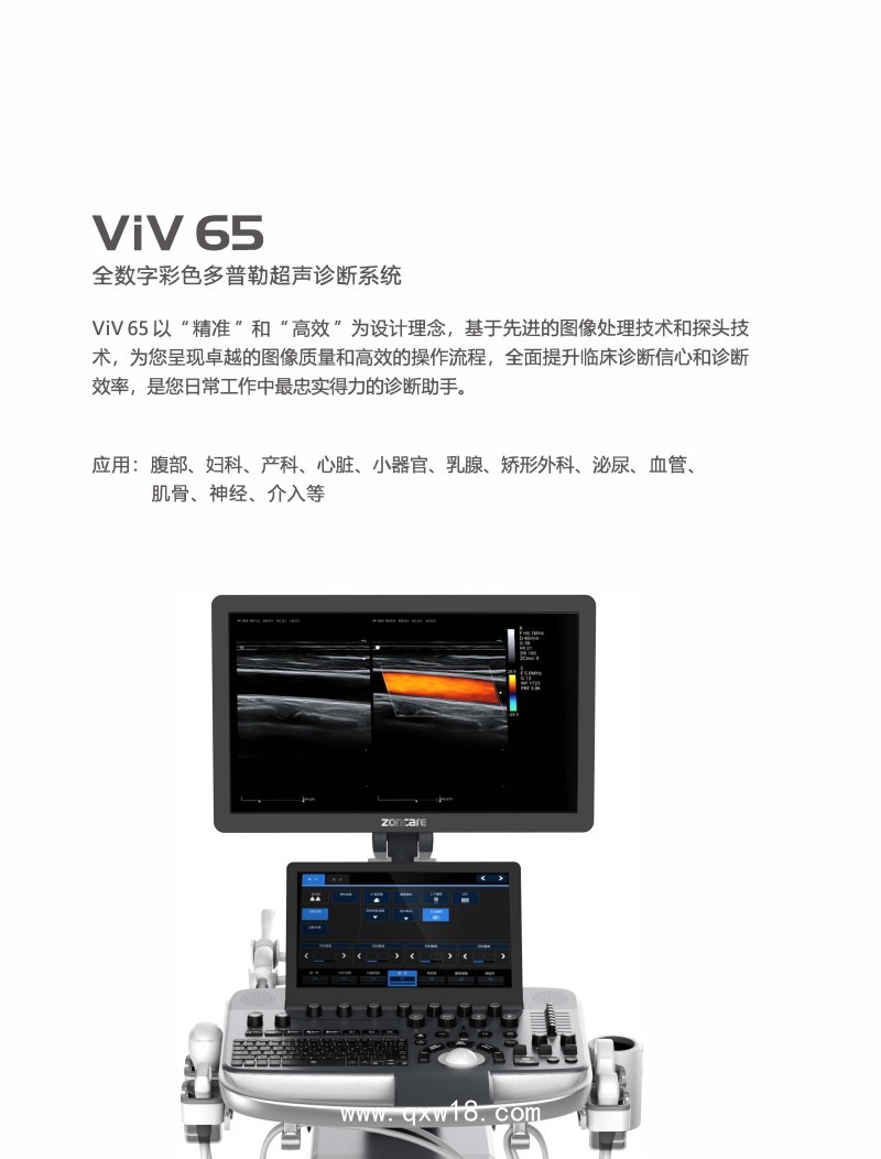 中旗 彩色多普勒超聲診斷系統VIV 65