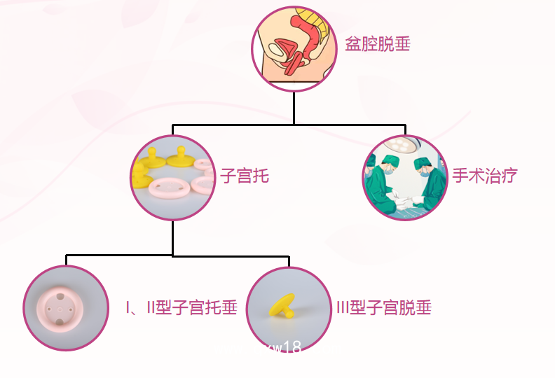 子宮托