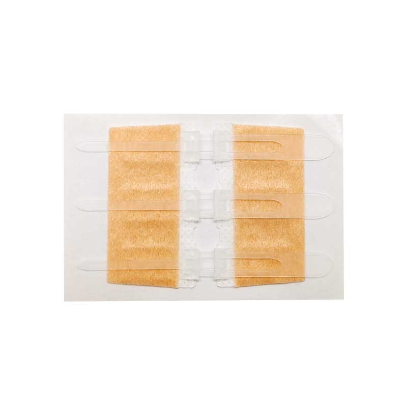 一次性使用免縫閉合器