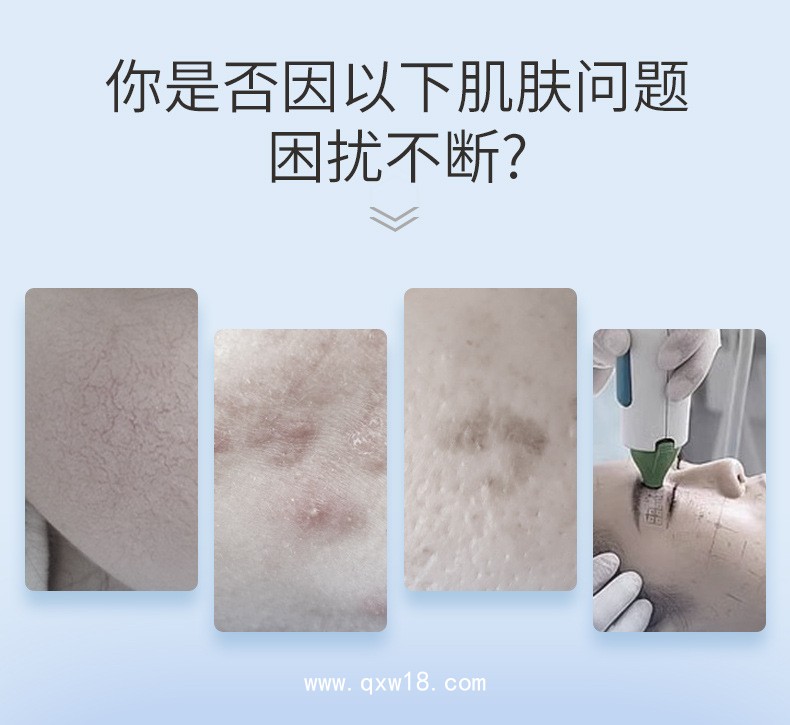 重組Ⅲ型人源化膠原蛋白敷料貼生產廠家 定制無菌械字號醫用冷敷貼